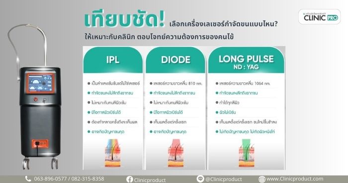 เครื่องเลเซอร์กำจัดขน